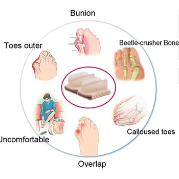 Инструмент для ухода за ногами Уход за ногами При вальгусной деформации большого пальца Ортопедические принадлежности Брекеты Для ежедневной коррекции большого пальца стопы из силикона