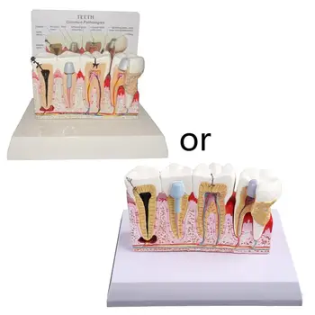 Стоматологическая модель M17F, анализ кариеса, проблемы с зубами, инструменты для обучения зубам